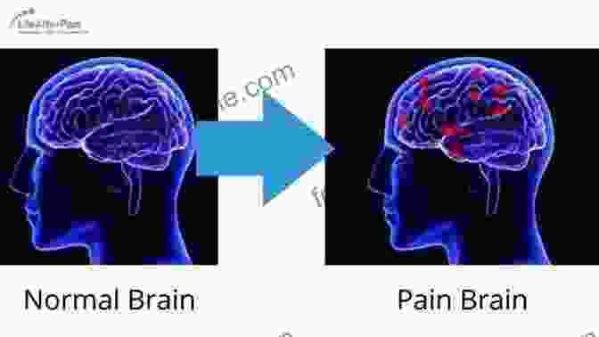 Brain Image Showing Areas Of Neuroplastic Change Synaptic Self: How Our Brains Become Who We Are