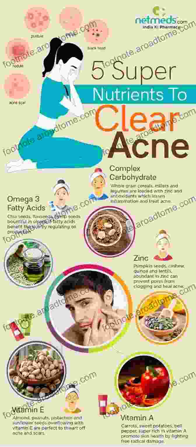 Healthy Diet For Acne Prevention How To Ger Rid Of Acne Scars And Pimples (Acne Treatments Acne Cure Acne Remedy Book) : Learn The Most Effective Methods And Natural Remedies To Cure Acne