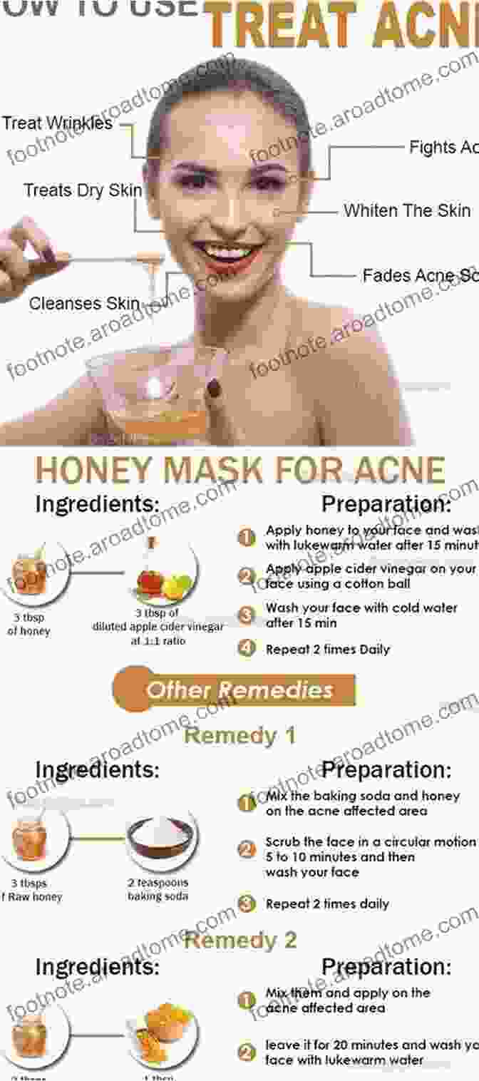 Honey For Acne Treatment How To Ger Rid Of Acne Scars And Pimples (Acne Treatments Acne Cure Acne Remedy Book) : Learn The Most Effective Methods And Natural Remedies To Cure Acne