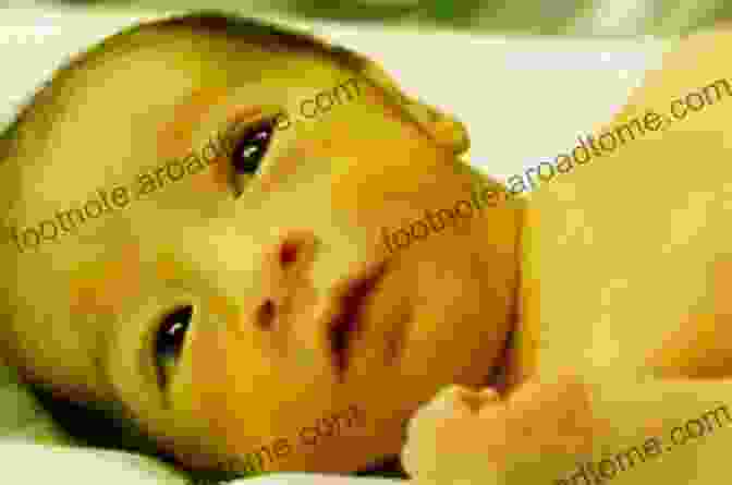 Newborn Baby With Jaundice 52 Helpful Tips For New Parents