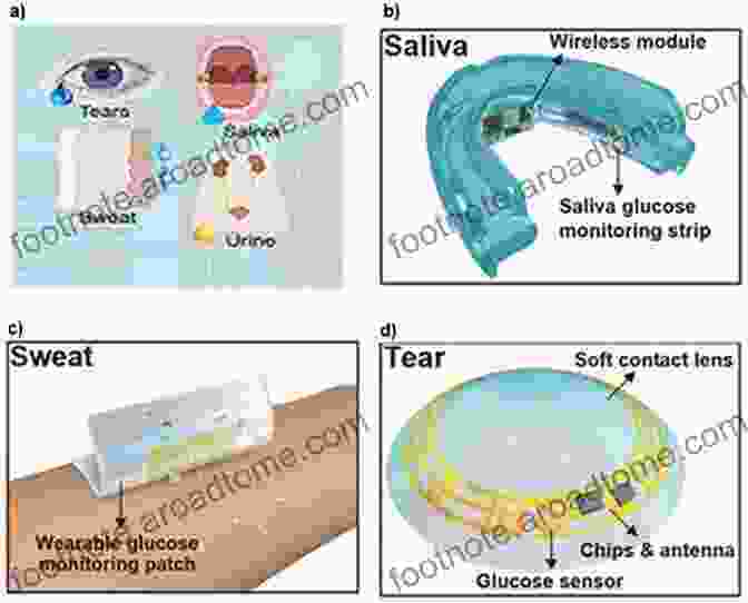 Schematic Representation Of A Wearable Biosensor For Glucose Monitoring Smart Biomaterials (NIMS Monographs) Mitsuhiro Ebara