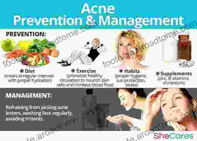 Stress Management For Acne Prevention How To Ger Rid Of Acne Scars And Pimples (Acne Treatments Acne Cure Acne Remedy Book) : Learn The Most Effective Methods And Natural Remedies To Cure Acne