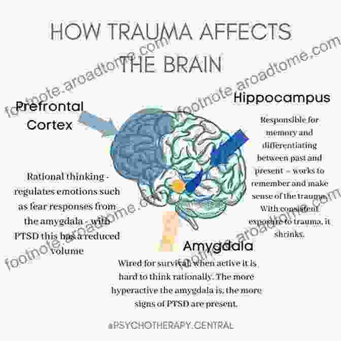 The Neurobiology Of Trauma Affects Brain Functions And Neural Pathways. Becoming Trauma Informed Robert Coles