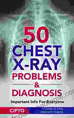 50 Chest X Ray Problems Diagnosis: Important Info For Everyone (X Ray Diagnostic Imaging 1)