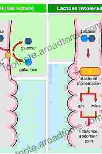 Food Intolerances: Fructose Malabsorption Lactose And Histamine Intolerance