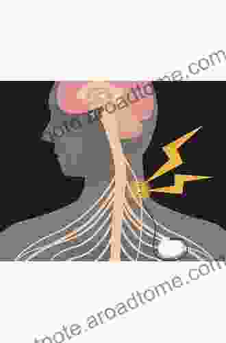 Vagus Nerve Stimulation Harriet Shawcross