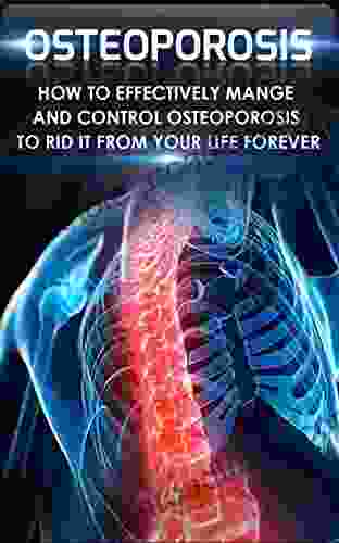 Osteoporosis: How To Effectively Control And Manage Osteoporosis To Rid It From Your Life Forever